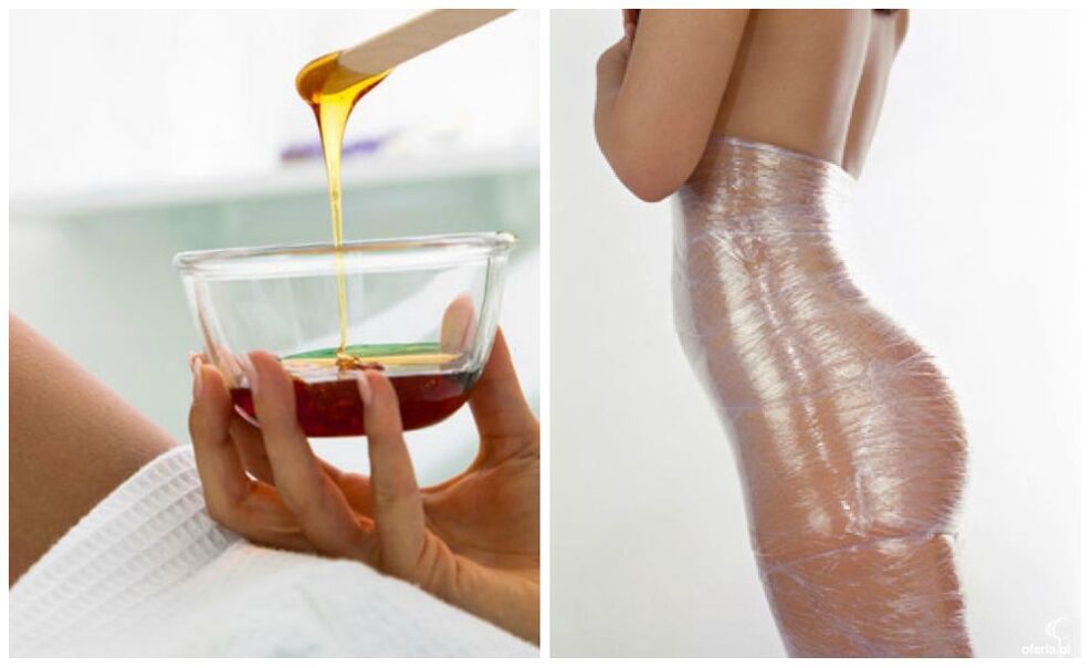 Body wraps for weight loss